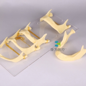“康為醫療”下頜骨發育模型