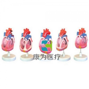 “康為醫療”先天性心臟畸形模型（5部件）